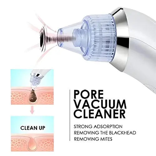 Derma Suction Blackheads Remover LivSmart