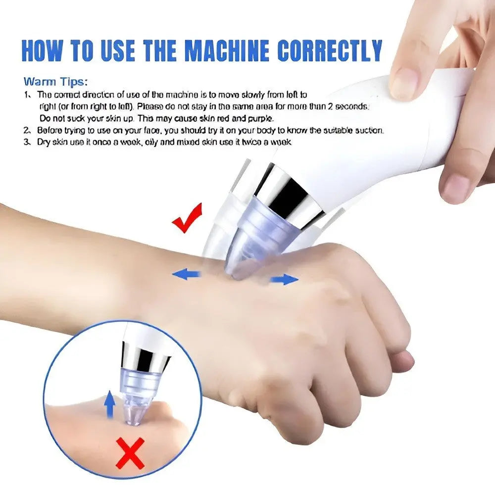 Derma Suction Blackheads Remover LivSmart