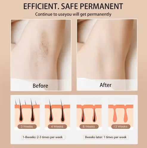 Babyverse - Digital IPL Hair Removal Device LivSmart