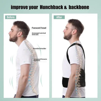 Back Pain Relief Belt | Instant Posture Corrector livSmart
